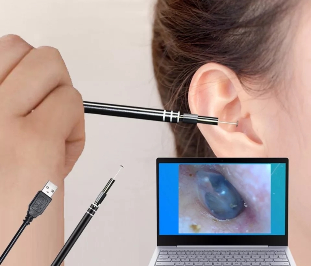 Digital microscope visual ear spoon - Image 7
