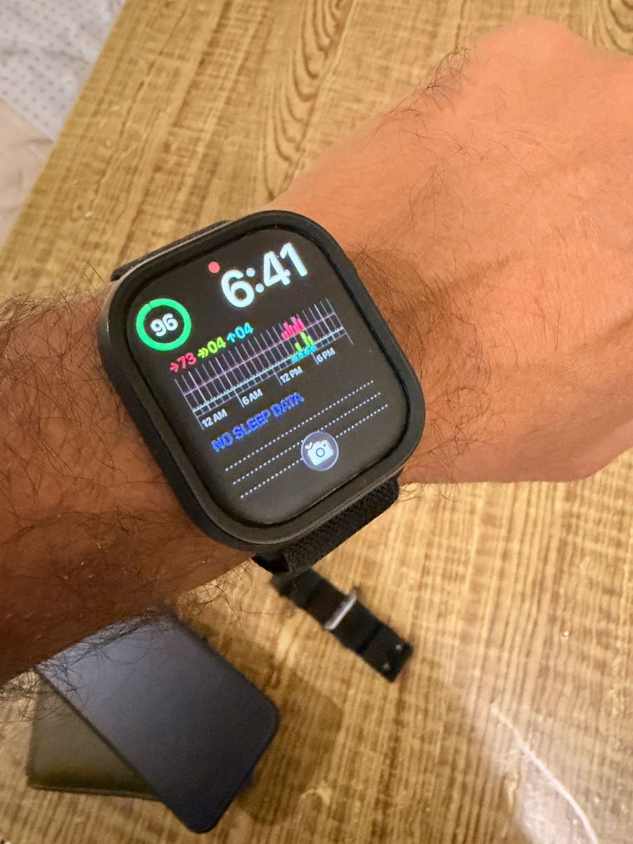 Apple Watch Series 10 - 46mm - Image 2