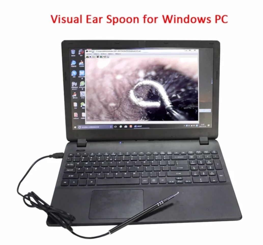 Digital microscope visual ear spoon - Image 6